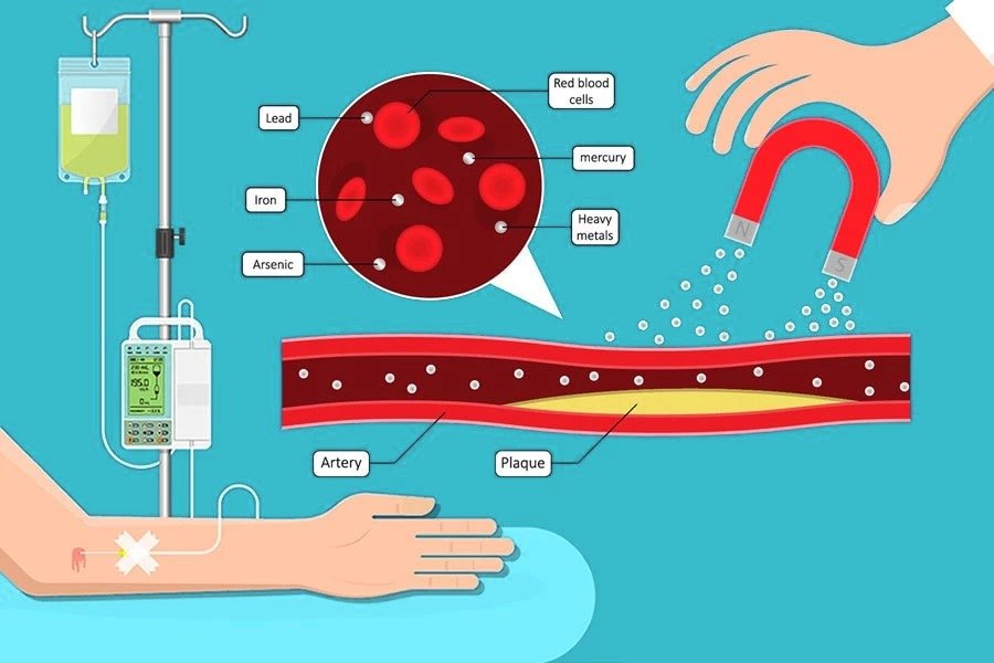 Chelation Therapy