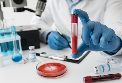 Down Syndrome - Blood Tests