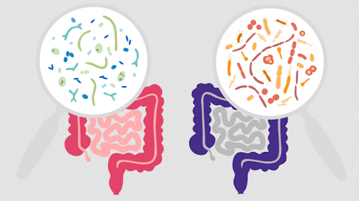 Gut Dysbiosis
