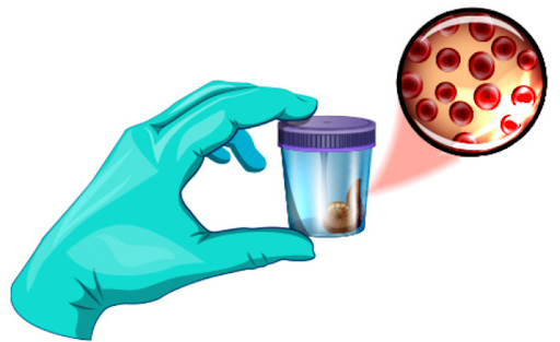 Blood and Stool Tests