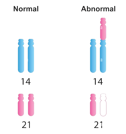 Translocation