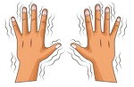 Dyskinetic