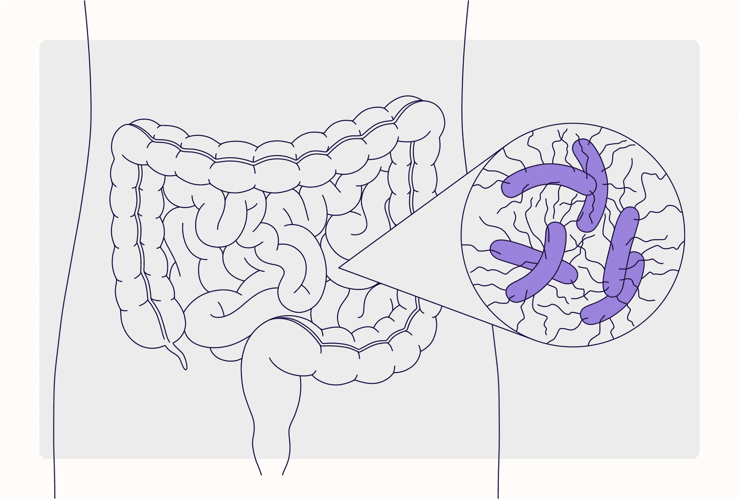 What is Clostridium difficile?