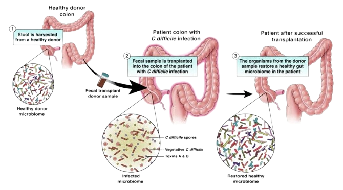 gut microbiota controls brain activity, metabolism, immunity