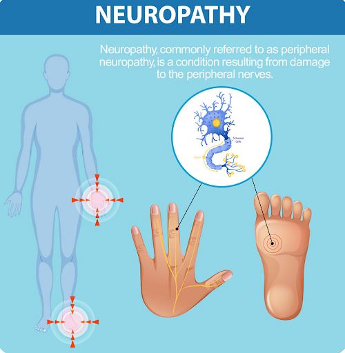 peripheral neuropathy