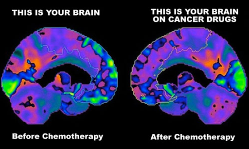 chemo brain